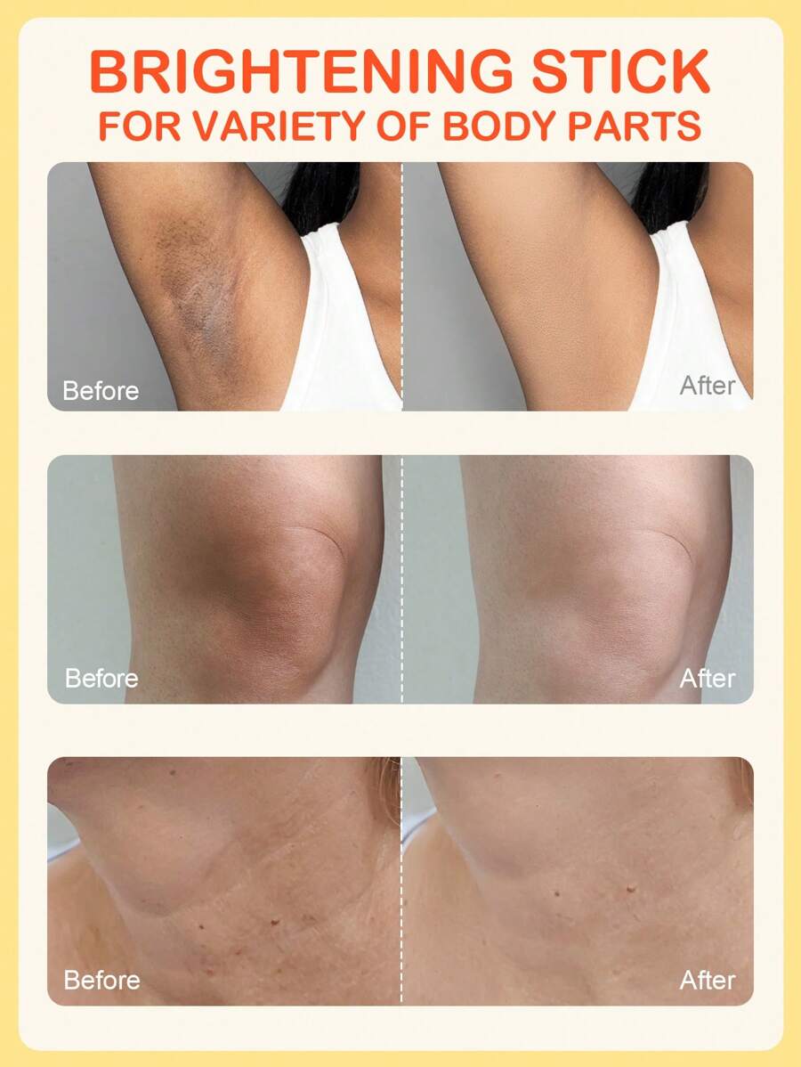Crema Cu Efect De Albire Si Curatare Pielei CU VITAMINA C