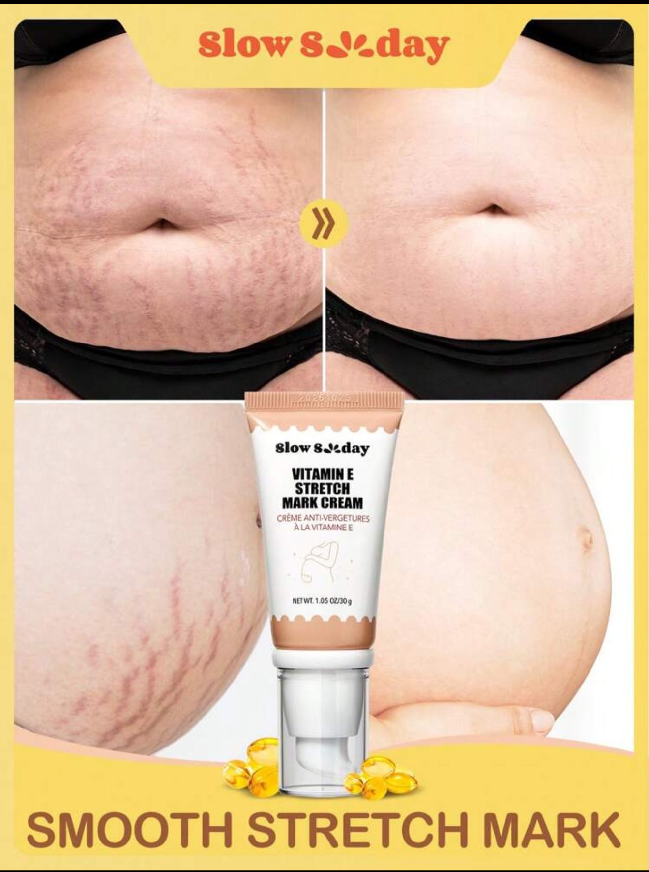 Crema AntiVergeturi